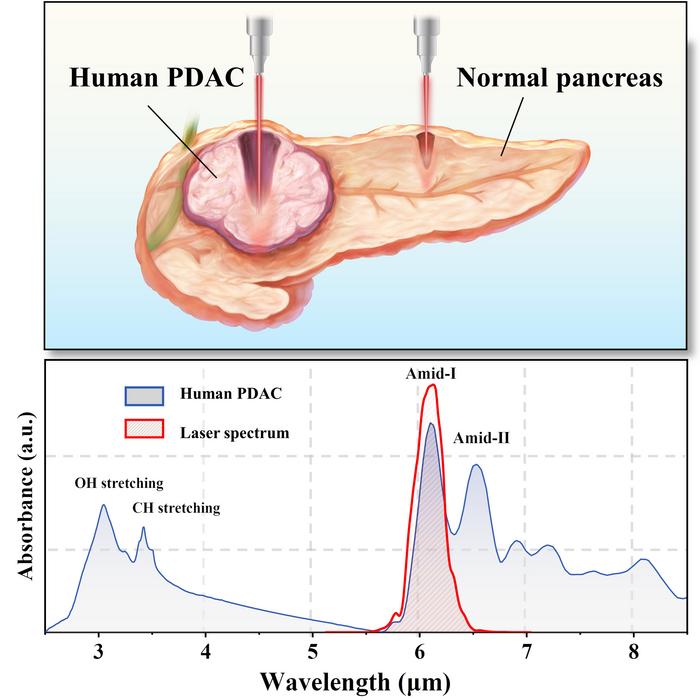 Selective tumor ablation via femtosecond laser resonant with collagen