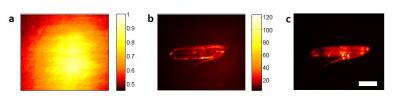 Comparison of Conventional vs. New Microscopy Technique
