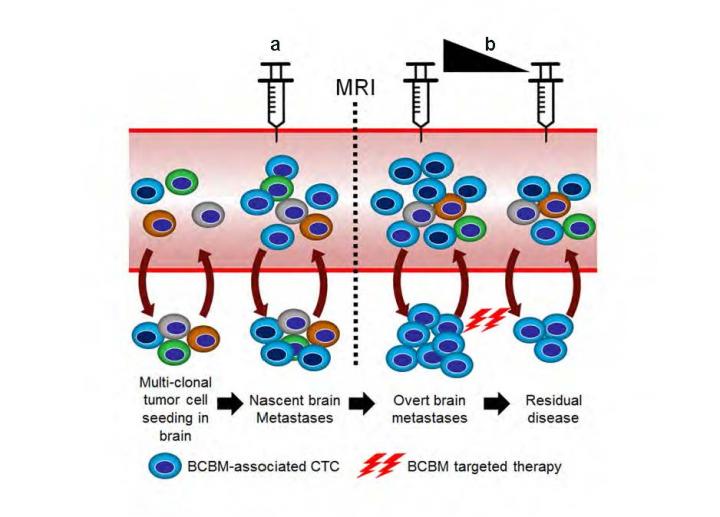 CTC Testing for BCBM Patients