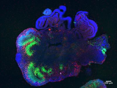 Building a Better Brain