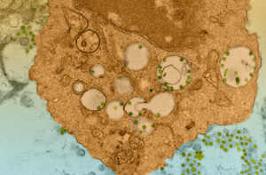 SARS-CoV-2 particles can be seen in a macrophage in the human lung tissue–engrafted model