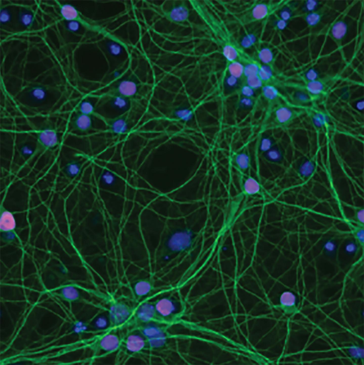 Identifying Genetic Suspects and Therapy Targets in ALS/FTD