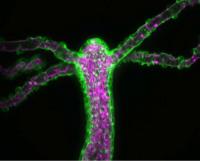 <em>Hydra vulgaris</em>