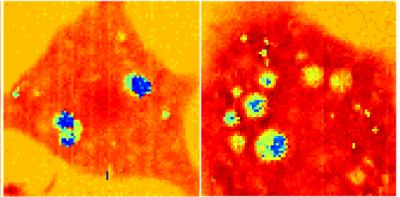 Fat Cell Genesis