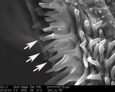 Modified Spines