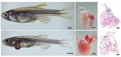 Zebrafish Offer Clues to a Heart Gone Wrong