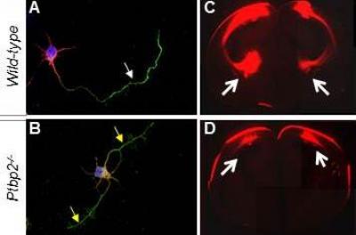 Axons