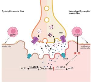 Novel Approach to Enhance Neuromuscular Function in Patients with Duchenne Muscular Dystrophy