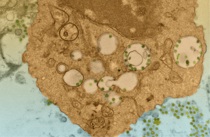 SARS-CoV-2 virus particles inside a macrophage