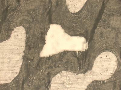 New Technique Yields Troves of Information From Nanoscale Bone Samples