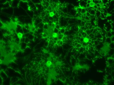 Oligodendrocytes
