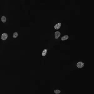 Dividing cells