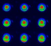 Regenerating Protoplast