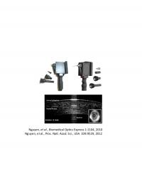 OCT Scanner and Retinal Image