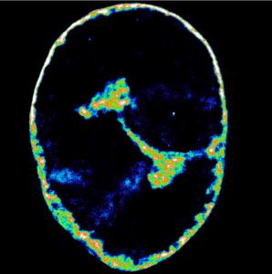 Human DNA eight hours after HSV-1 infection