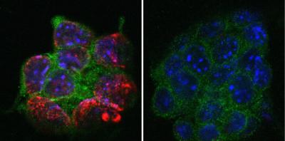 Scientists Find Missing Link between Players in the Epigenetic Code