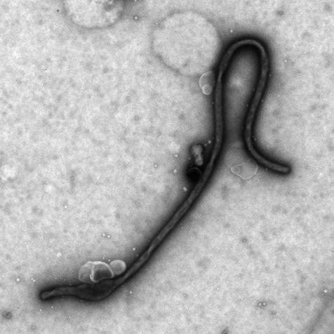 Image of Virus