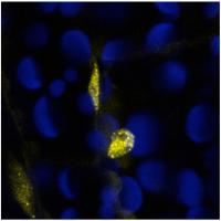 Here Comes the Sun: Cellular Sensor Helps Plants Find Light