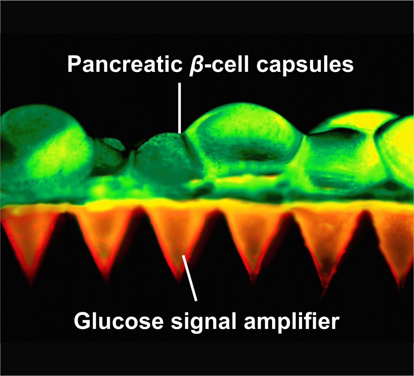 Microneedle Patch Close Up