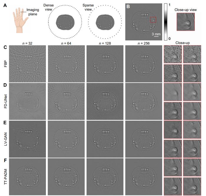 TT-PADM achieves high-quality image restoration in human finger imaging