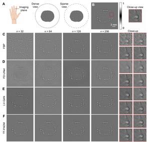 TT-PADM achieves high-quality image restoration in human finger imaging