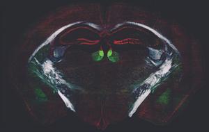 Brain learning