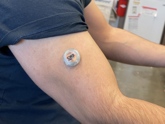 Multi-tasking microneedle wearable - 1