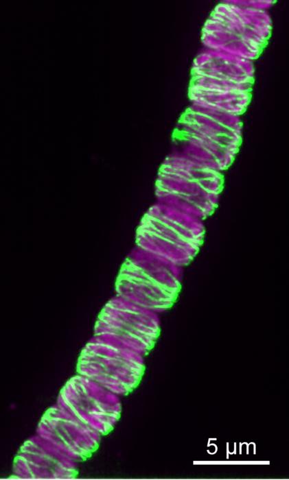 CorM filaments in Anabaena