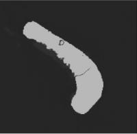Manufacturing - Defect detection