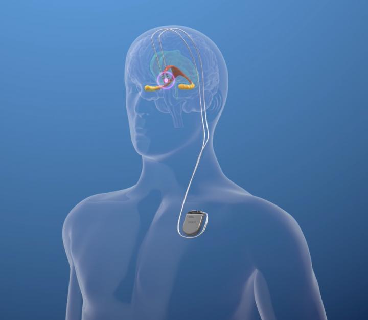 Picture of the brain