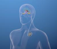 Picture of the brain