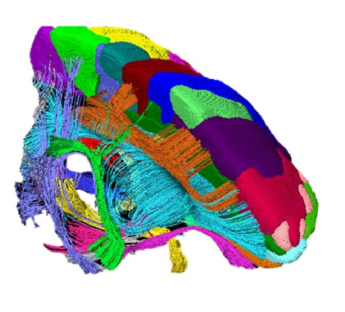 Brain Scans from MRI