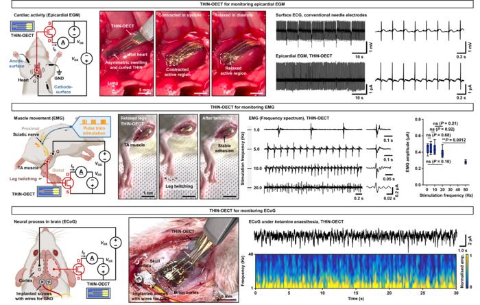 Figure 3. THIN-based organic electrochemical transistor (OECT) interface for real-time amplification and monitoring of bio-signals