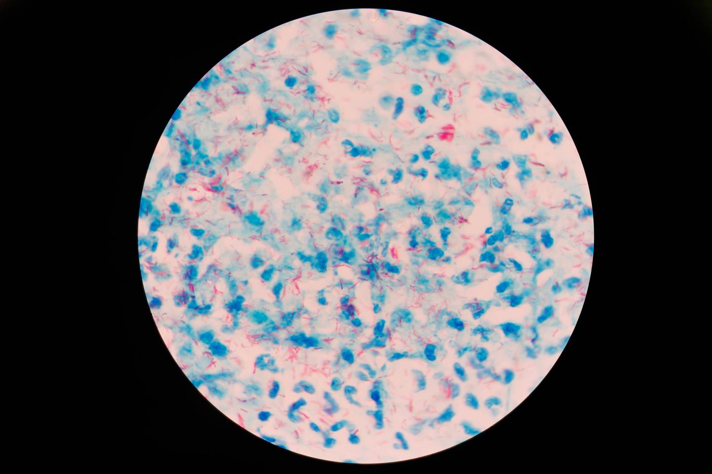 Mycobacterium tuberculosis