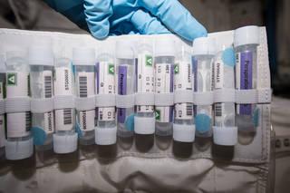 Microbiome Swab Kit 
