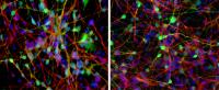 New Method Predicts Who Will Respond to Lithium Therapy