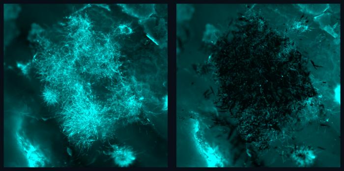 Before and after antifungal robotic swarm erradicates Candida albicans
