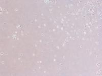 Omega-3 Treated Cancer Keratinocytes