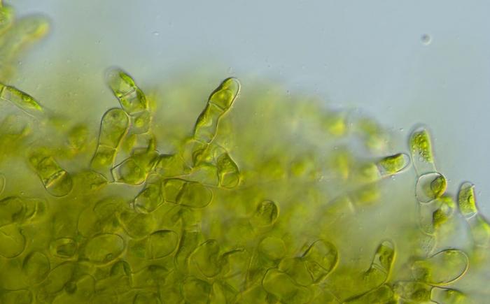 Komplexität durch das Lichtmikroskop betrachtet: Einige Arten der Gruppe Coleochaete bilden Geflechte aus dicht gepackten Zellfäden.