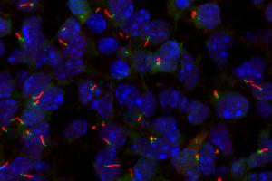 Primary Cilia