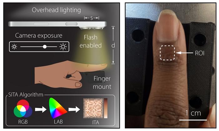 Proposed smartphone colorimeter measures at a common anatomical site (ROI) for pulse oximetry.