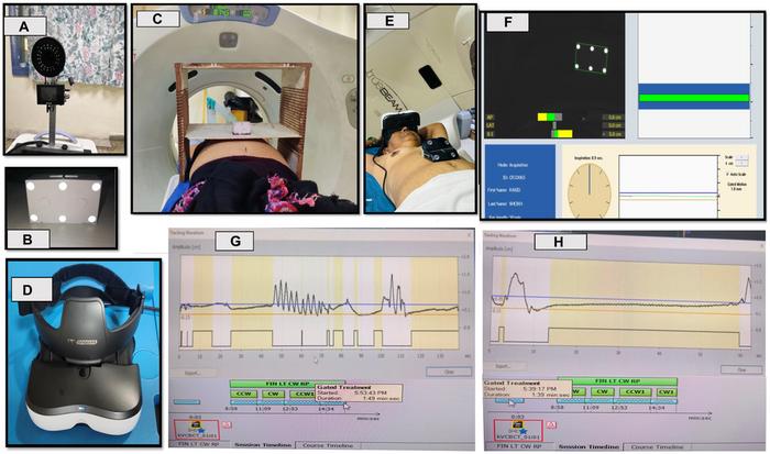 Investigating the role of 3D goggles in optimising time during deep-inspiratory breath-hold radiotherapy: A randomised study