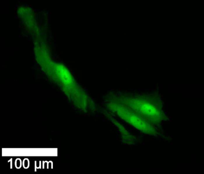 cancer cells
