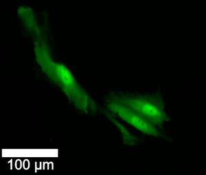 cancer cells