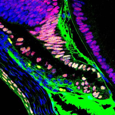 Notch2 Mutant Ciliary Body