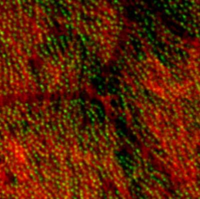 <I>Schmidtea mediterranea</I> Ciliated Cells