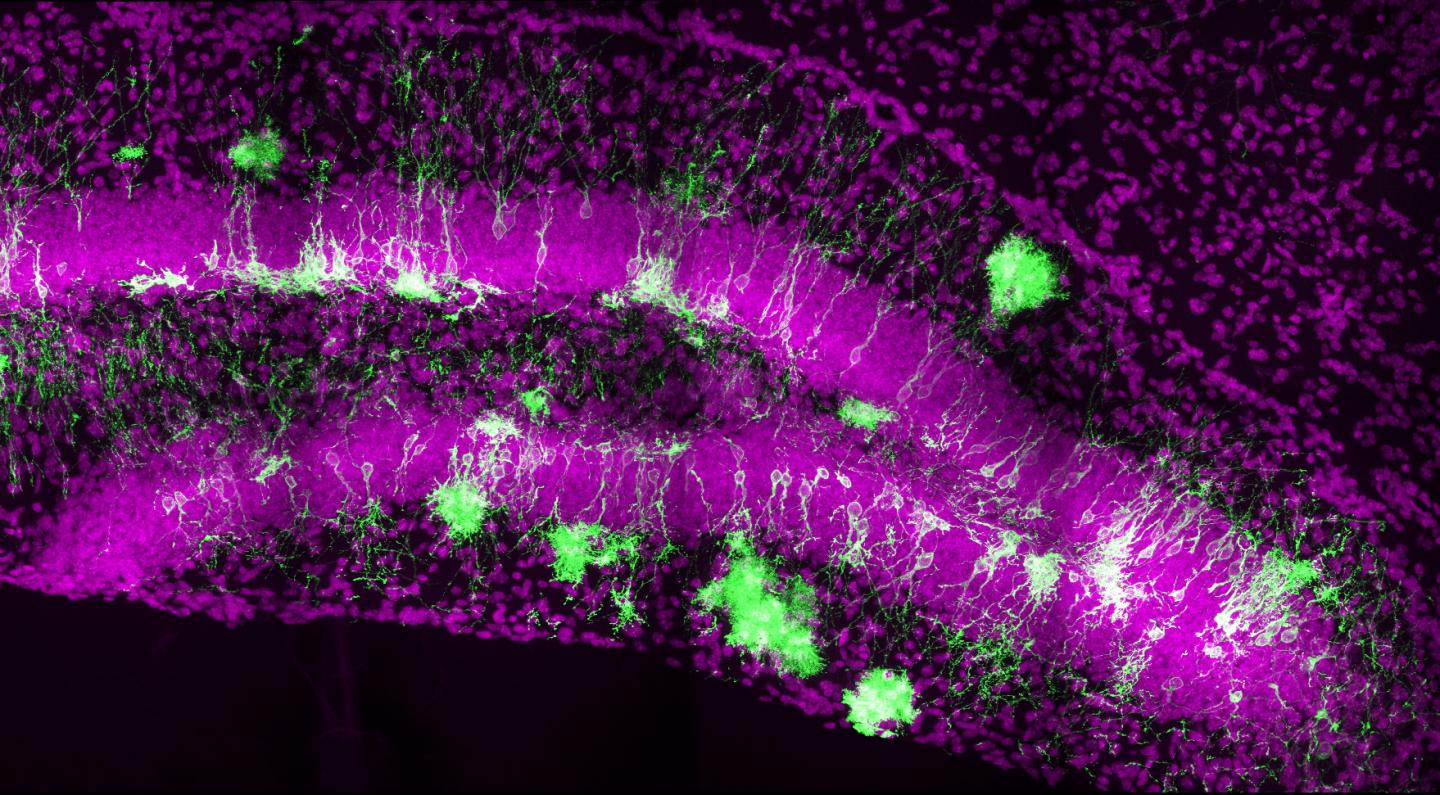 Mouse Hippocampus