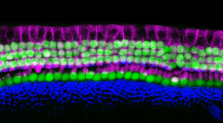 The Hearing Organ of the Inner Ear