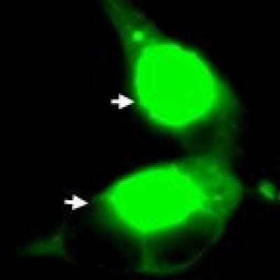 Large Aggregates in NSC34 Cells