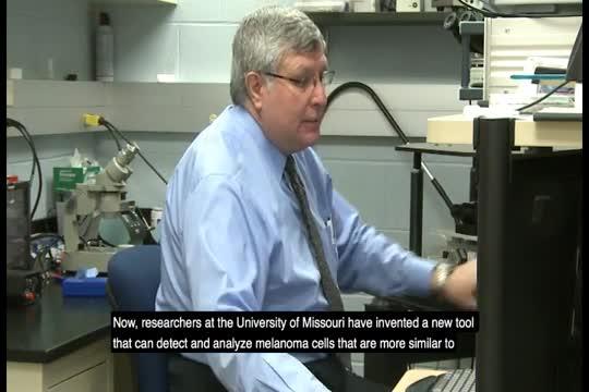 Fighting cancer: New microscopic technique could help detect, diagnose metastatic melanomas